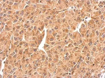 Anti-RAB5A antibody used in IHC (Paraffin sections) (IHC-P). GTX109665