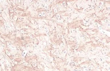 Anti-RAB5A antibody used in IHC (Paraffin sections) (IHC-P). GTX109665
