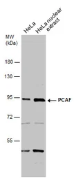 Anti-PCAF antibody [C3], C-term used in Western Blot (WB). GTX109666