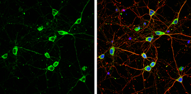 Anti-Calnexin antibody [C3], C-term used in Immunocytochemistry/ Immunofluorescence (ICC/IF). GTX109669