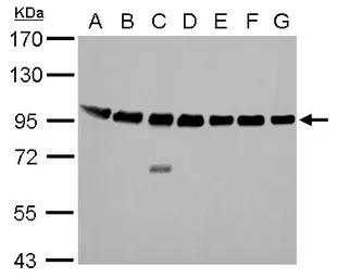Anti-Calnexin antibody [C3], C-term used in Western Blot (WB). GTX109669