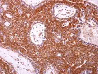 Anti-Bax antibody [N1N2], N-term used in IHC (Paraffin sections) (IHC-P). GTX109683