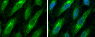 Anti-Bax antibody [N1N2], N-term used in Immunocytochemistry/ Immunofluorescence (ICC/IF). GTX109683