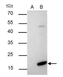 Anti-Bax antibody [N1N2], N-term used in Immunoprecipitation (IP). GTX109683