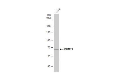 Anti-POMT1 antibody [C1C3] used in Western Blot (WB). GTX109717