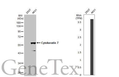 Anti-Cytokeratin 7 antibody [N1C2] used in Western Blot (WB). GTX109723