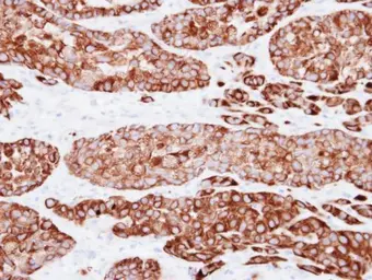 Anti-Cytokeratin 7 antibody [N1C2] used in IHC (Paraffin sections) (IHC-P). GTX109723