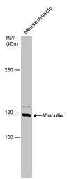 Anti-Vinculin antibody [N3C1], Internal used in Western Blot (WB). GTX109749