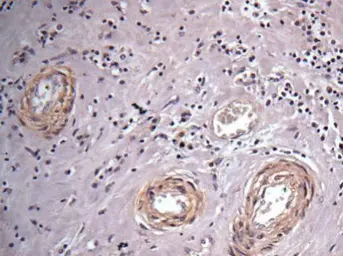 Anti-Vinculin antibody [N3C1], Internal used in IHC (Paraffin sections) (IHC-P). GTX109749