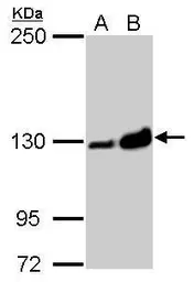 Anti-Vinculin antibody [N3C1], Internal used in Western Blot (WB). GTX109749