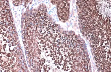 Anti-Hsp90 alpha antibody used in IHC (Paraffin sections) (IHC-P). GTX109753