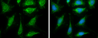 Anti-DLAT antibody used in Immunocytochemistry/ Immunofluorescence (ICC/IF). GTX109766