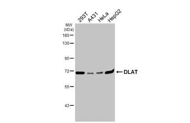 Anti-DLAT antibody used in Western Blot (WB). GTX109766