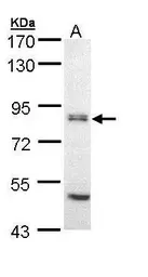 Anti-EIF2B epsilon antibody used in Western Blot (WB). GTX109799