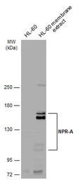 Anti-NPR-A antibody used in Western Blot (WB). GTX109810