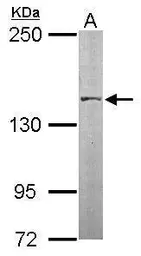 Anti-SMC3 antibody [N1N2], N-term used in Western Blot (WB). GTX109827