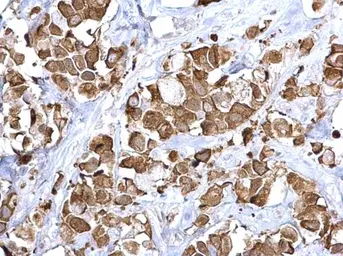 Anti-Fatty Acid Synthase antibody [N1], N-term used in IHC (Paraffin sections) (IHC-P). GTX109833