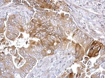Anti-Fatty Acid Synthase antibody [N1], N-term used in IHC (Paraffin sections) (IHC-P). GTX109833