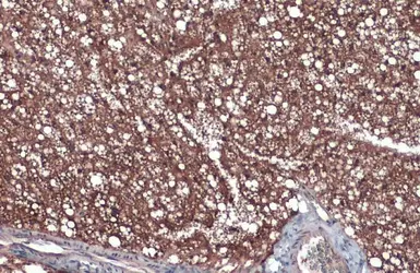 Anti-Fatty Acid Synthase antibody [N1], N-term used in IHC (Paraffin sections) (IHC-P). GTX109833