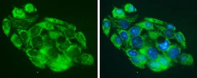 Anti-MARS antibody [N3C2], Internal used in Immunocytochemistry/ Immunofluorescence (ICC/IF). GTX109864