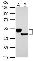 Anti-Cytokeratin 13 antibody used in Western Blot (WB). GTX109883