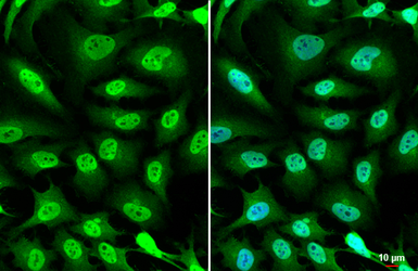 Anti-TCF3 / E2A antibody used in Immunocytochemistry/ Immunofluorescence (ICC/IF). GTX109885