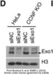 Anti-Exonuclease 1 antibody used in Western Blot (WB). GTX109891