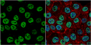 Anti-Exonuclease 1 antibody used in Immunocytochemistry/ Immunofluorescence (ICC/IF). GTX109891