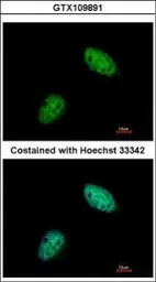 Anti-Exonuclease 1 antibody used in Immunocytochemistry/ Immunofluorescence (ICC/IF). GTX109891