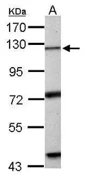 Anti-Exonuclease 1 antibody used in Western Blot (WB). GTX109891