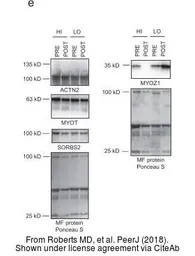 Anti-Myotilin antibody used in Western Blot (WB). GTX109905