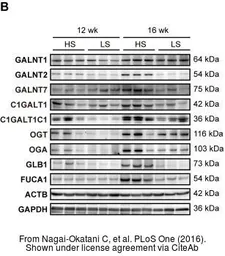 Anti-O-GlcNAc transferase antibody used in Western Blot (WB). GTX109939