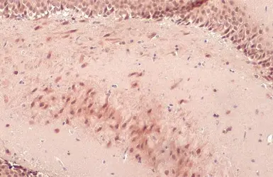Anti-O-GlcNAc transferase antibody used in IHC (Paraffin sections) (IHC-P). GTX109939