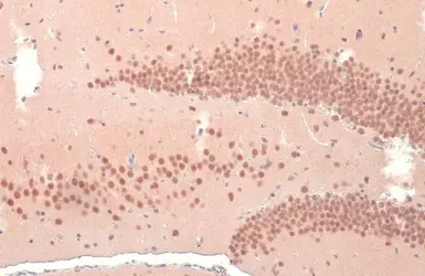 Anti-O-GlcNAc transferase antibody used in IHC (Paraffin sections) (IHC-P). GTX109939