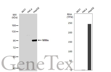 Anti-Villin antibody used in Western Blot (WB). GTX109940