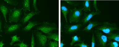 Anti-Vitamin D Binding Protein antibody used in Immunocytochemistry/ Immunofluorescence (ICC/IF). GTX109955