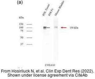 Anti-COL6A1 antibody [C1C2], Internal used in Western Blot (WB). GTX109963
