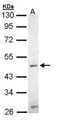 Anti-ZIC3 antibody [N3C3] used in Western Blot (WB). GTX109987