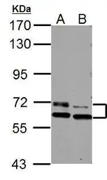 Anti-PAK3 antibody used in Western Blot (WB). GTX109991