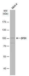 Anti-OFD1 antibody used in Western Blot (WB). GTX110010