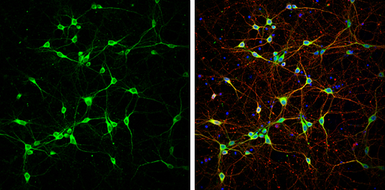 Anti-NF-H antibody used in Immunocytochemistry/ Immunofluorescence (ICC/IF). GTX110065