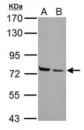 Anti-HSPA2 antibody used in Western Blot (WB). GTX110079