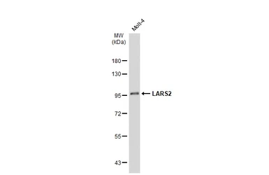 Anti-LARS2 antibody [N2C1], Internal used in Western Blot (WB). GTX110083