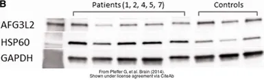 Anti-HSP60 antibody used in Western Blot (WB). GTX110089