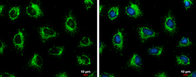 Anti-HSP60 antibody used in Immunocytochemistry/ Immunofluorescence (ICC/IF). GTX110089