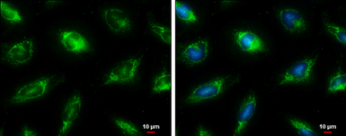 Anti-Fumarate hydratase antibody [N2C2], Internal used in Immunocytochemistry/ Immunofluorescence (ICC/IF). GTX110128