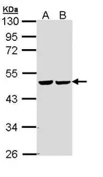 Anti-Fumarate hydratase antibody [N2C2], Internal used in Western Blot (WB). GTX110128
