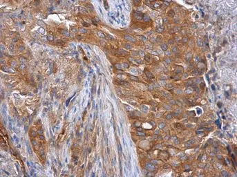 Anti-Tara antibody [C2C3-2], C-term used in IHC (Paraffin sections) (IHC-P). GTX110158