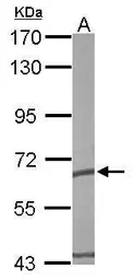 Anti-TCP1 epsilon antibody [N1C1] used in Western Blot (WB). GTX110167