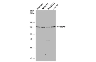 Anti-HDAC4 antibody [N3C1], Internal used in Western Blot (WB). GTX110231